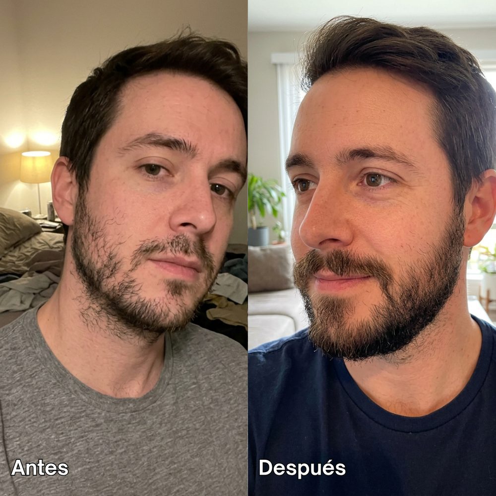Antes y después 6