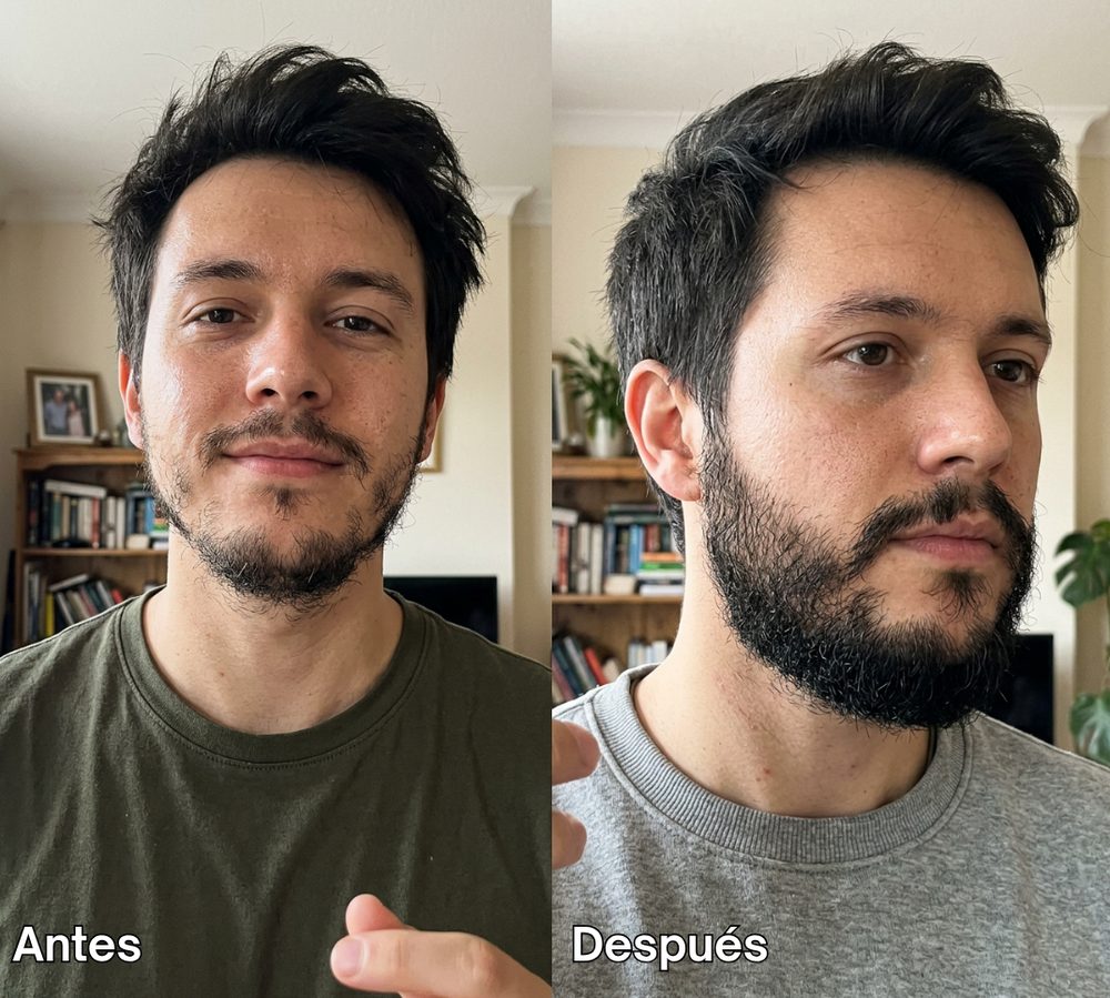 Antes y después 4
