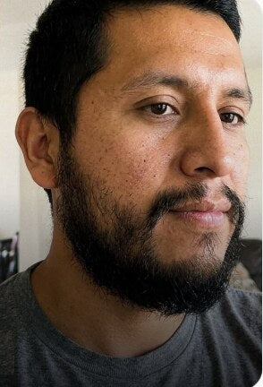Densidad en 12 semanas — después